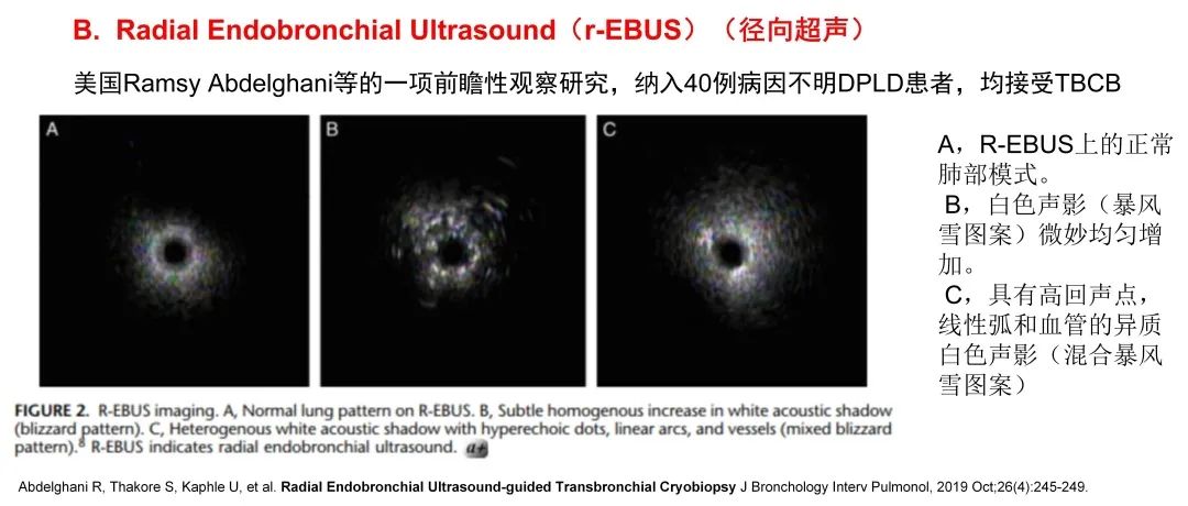 经皮肺穿刺活检术过程,经支气管冷冻肺活检