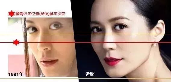 一次解决法令纹的方法,改善法令纹一看就学会