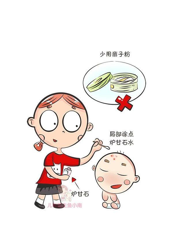 小朋友起皮疹热疹抹什么药,孩子过敏皮疹和热疹有啥区别