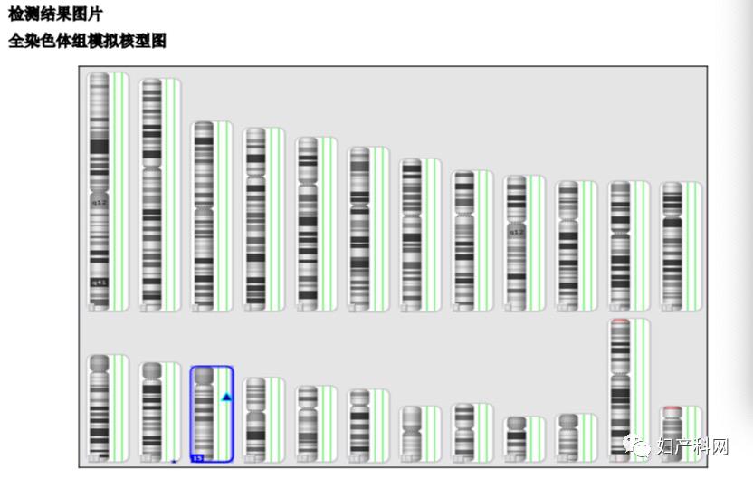 胎儿染色体检查出特纳综合征,孕妇特纳综合征的症状