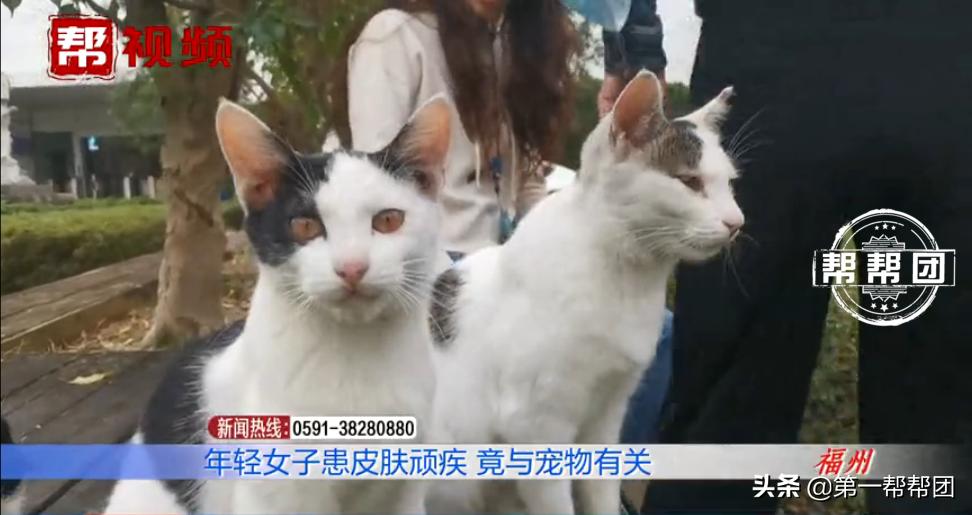 人传染上猫癣身上痒,七岁女孩染上猫癣