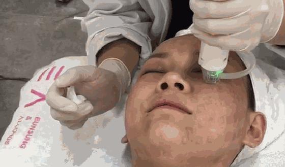 关于激光美容的几个误区你知道吗,走出激光美容的10个误区