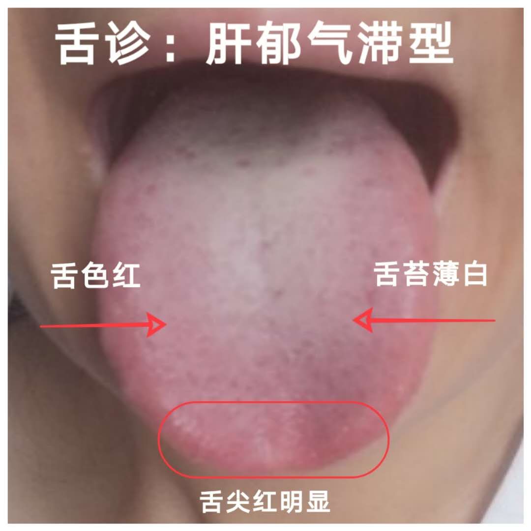 容易生闷气是什么心理,女生容易生闷气