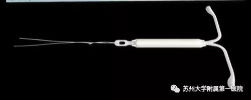 为什么只是痛经，医生却让我上环？