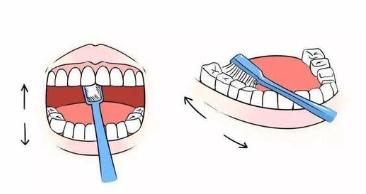 拔牙后出血的原因及处理措施,拔牙后出血自我处理小妙招