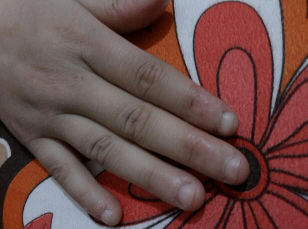 怎么预测小孩长大能长多高,孩子大高个