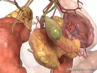 胆囊结石1.4厘米能保胆取石么,胆囊结石一厘米可以保胆取石吗