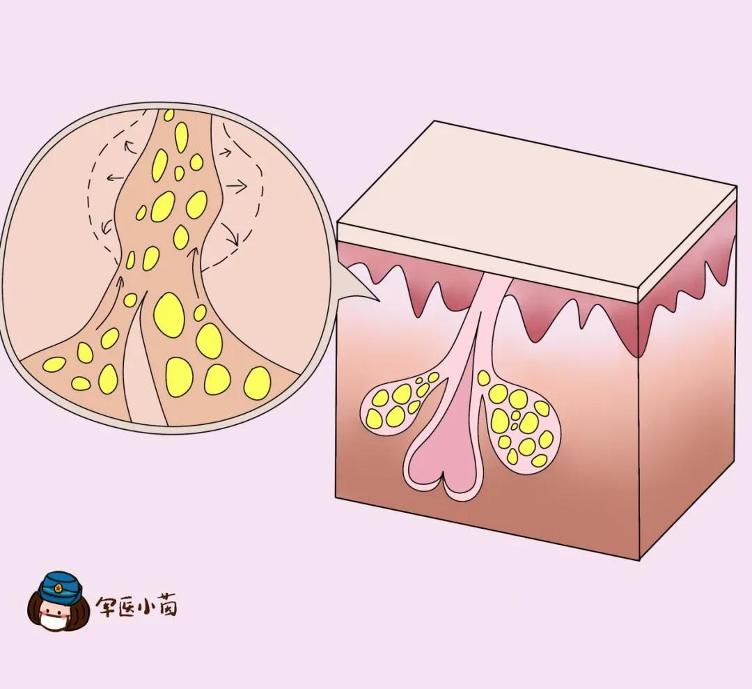 军医小茵丨今日立秋