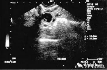 排卵试纸测不出来排卵怎么办,排卵试纸怎么测排卵最准