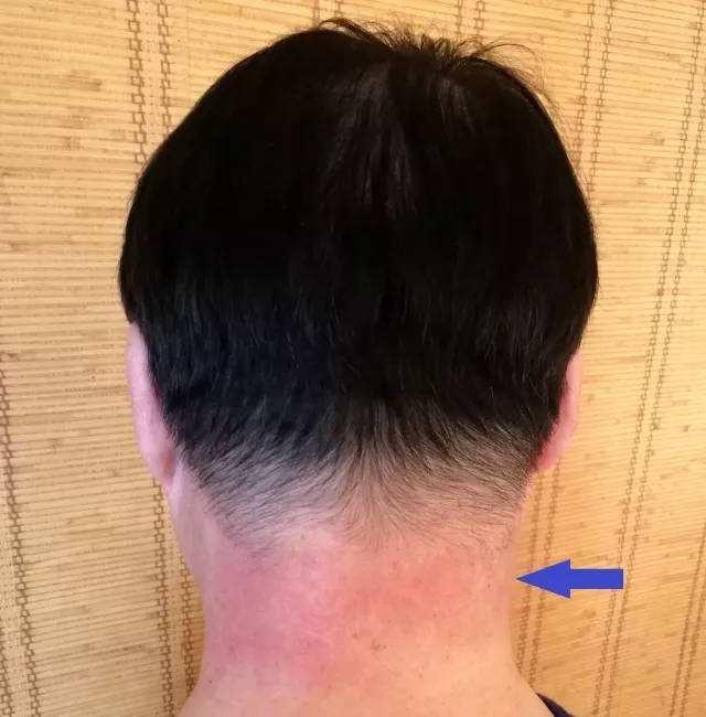 暑假去游泳该带些什么,夏天去游泳容易出现什么问题