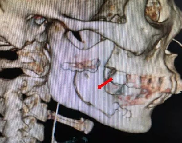 多大年龄出现牙痛,小小年纪就有牙痛怎么办