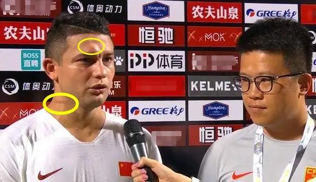 足球的根本是技术