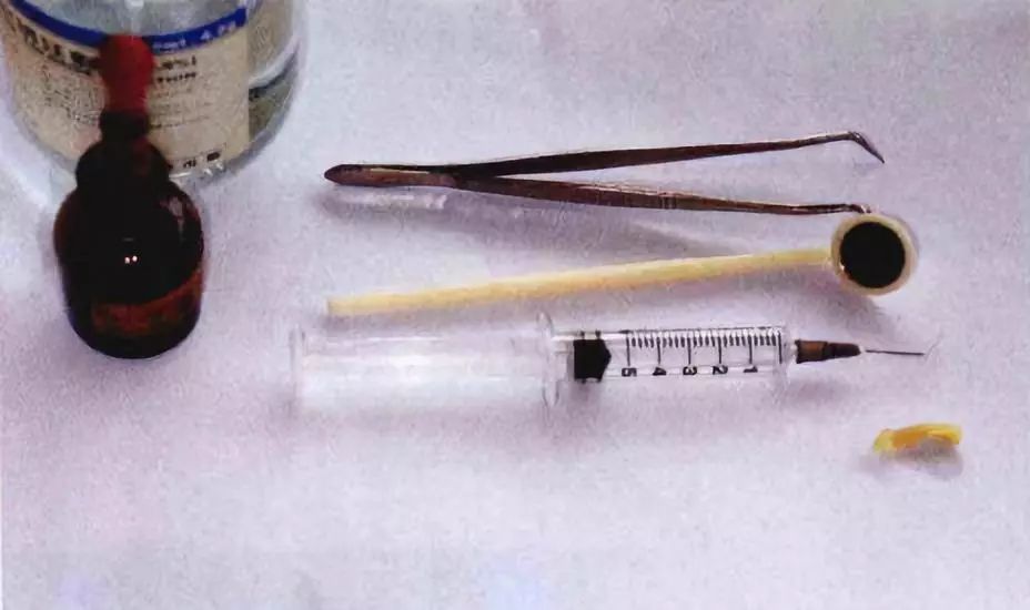 拔一颗牙寿命减三年这是真的吗,拔一颗牙的好处和坏处