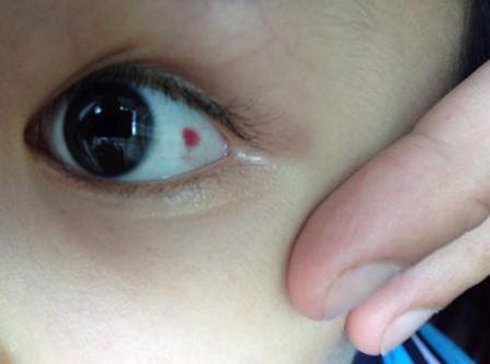 刚出生的宝宝哪21种情况不是病,刚出生的婴儿会出现什么症状