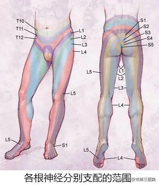 【医者解读】揭开“骶管囊肿”之神秘面纱，查出骶管囊肿都需要治疗吗？（手术病例+文献回顾）