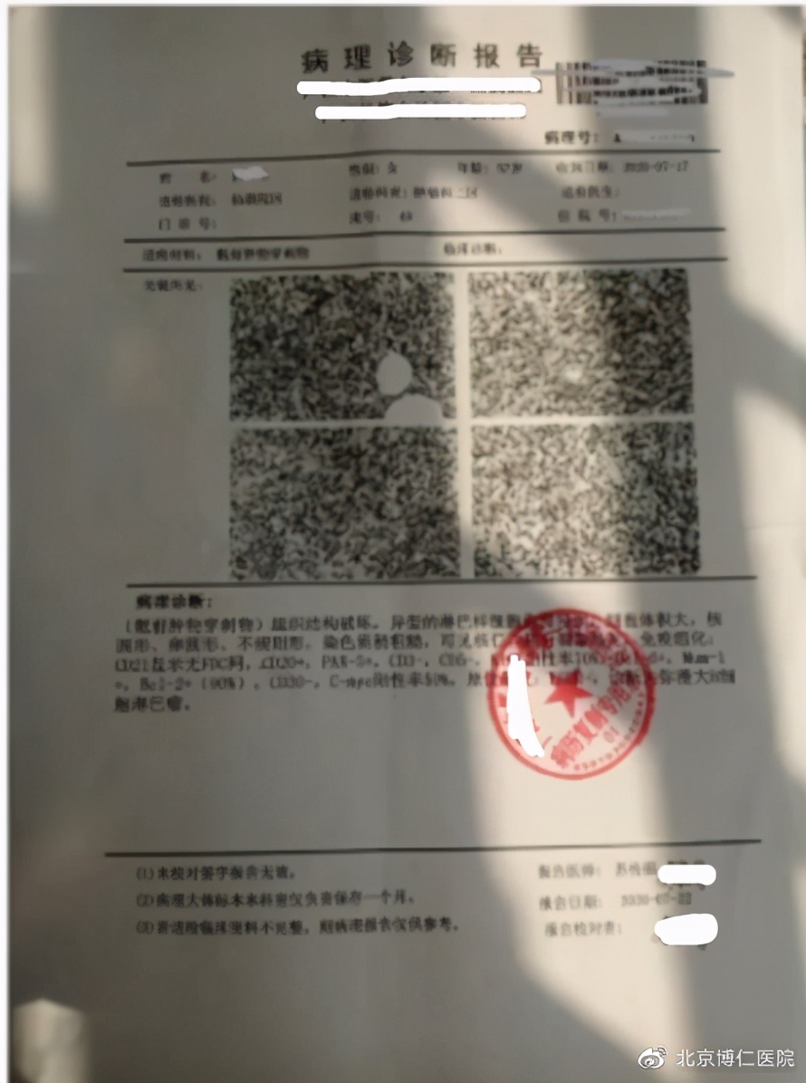 确诊淋巴瘤的最可靠依据是什么,我的淋巴瘤是遗传的能治好吗