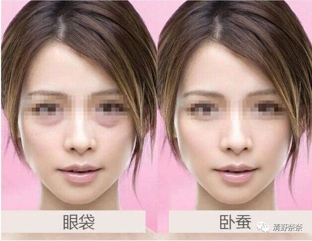 黑眼圈和眼袋可以通过眼霜消除吗,用什么样的眼霜能去除眼袋黑眼圈
