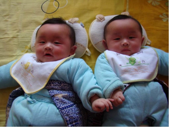 一岁婴儿脸上过敏湿疹痒怎么解决,1岁半宝宝脸上出湿疹可以抹点啥