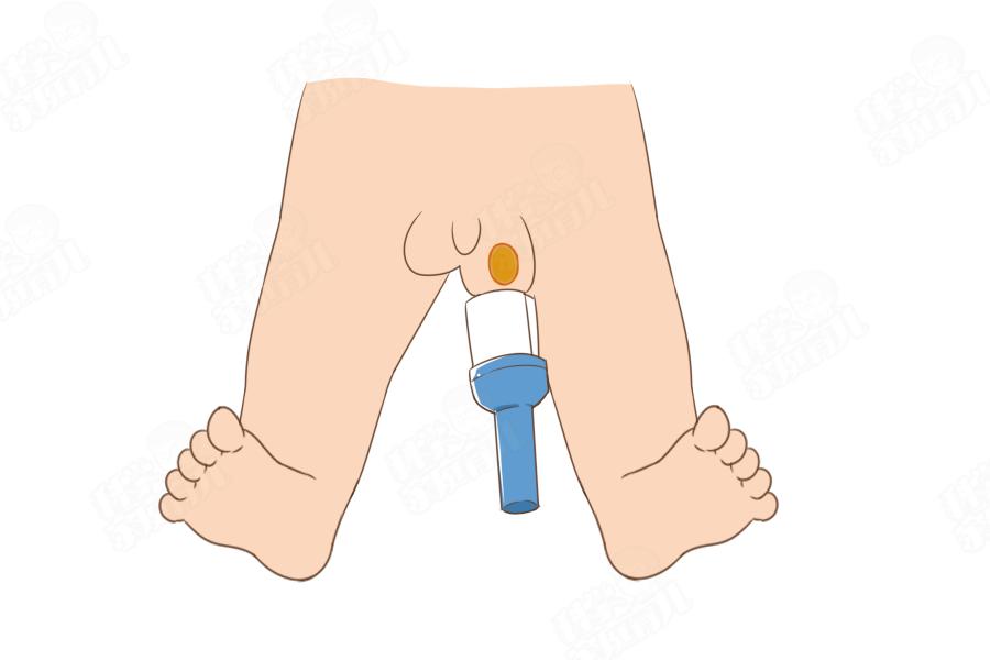 错不起!娃包皮长、丁丁小,7大*处私**异常,立马送医