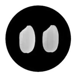 米饭辟谣,有虫的大米可以吃吗