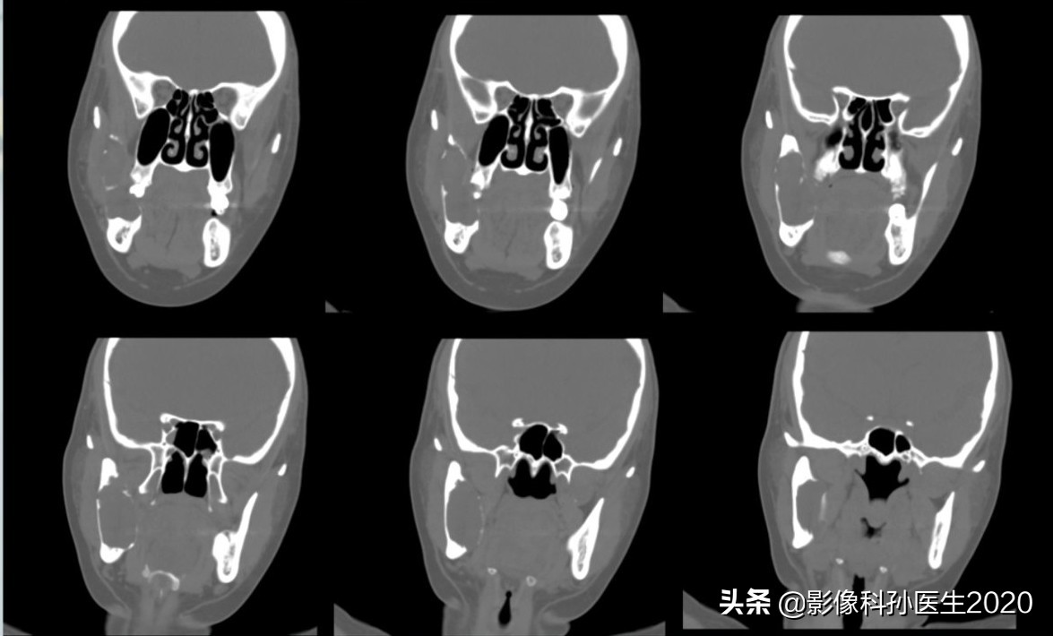 case10什么意思,case案例合集
