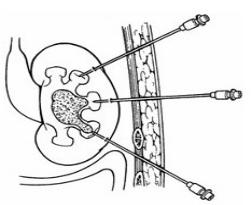 山东治疗泌尿外科比较好的医院,山东大学附属医院泌尿外科专家