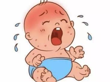 冬天宝宝脸红红是冻疮,冬季注意宝宝冻疮的预防