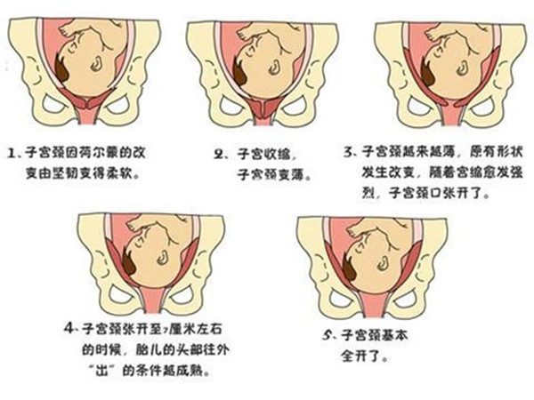 少女胯和妈妈胯怎么区分,女生胯是什么时候发育的