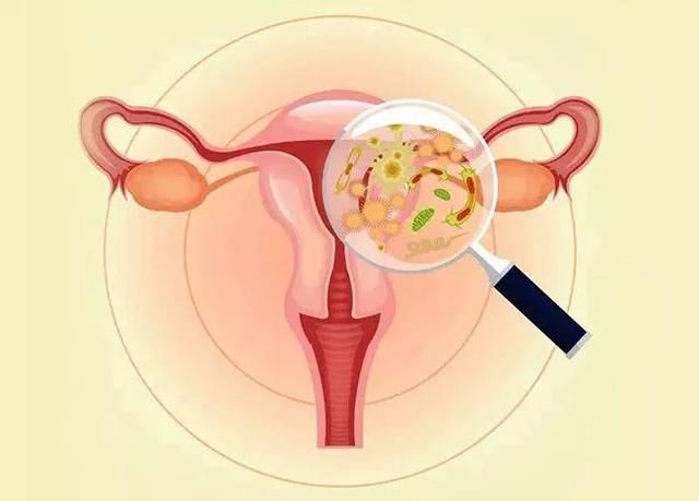 阴道炎会导致胎儿早产？孕期一定要注意这些细节