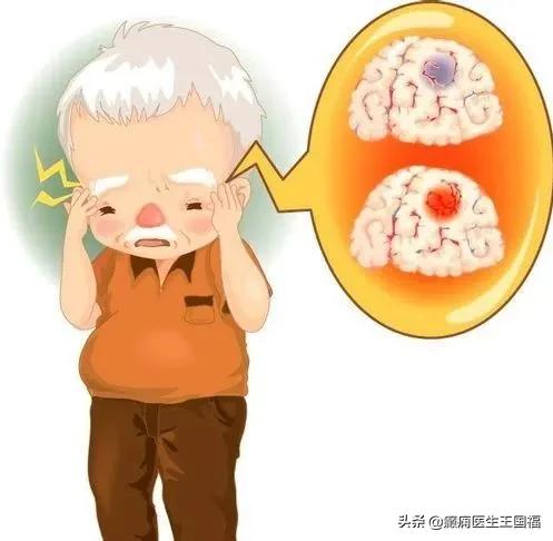 脑卒中头晕,脑卒中的头疼是一点一点的疼