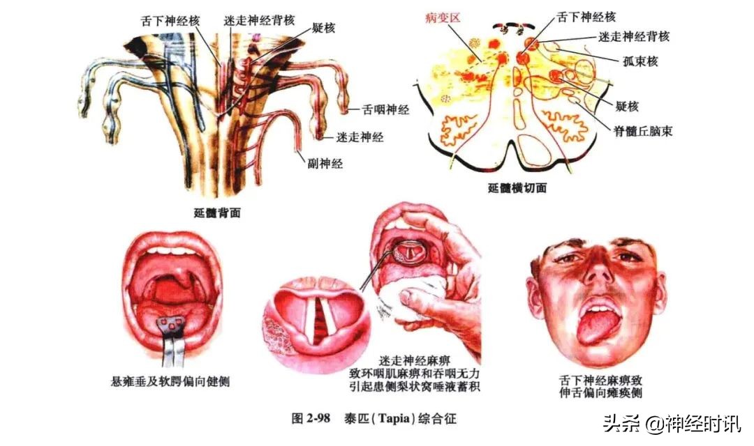 脑干解剖,脑干神经解剖