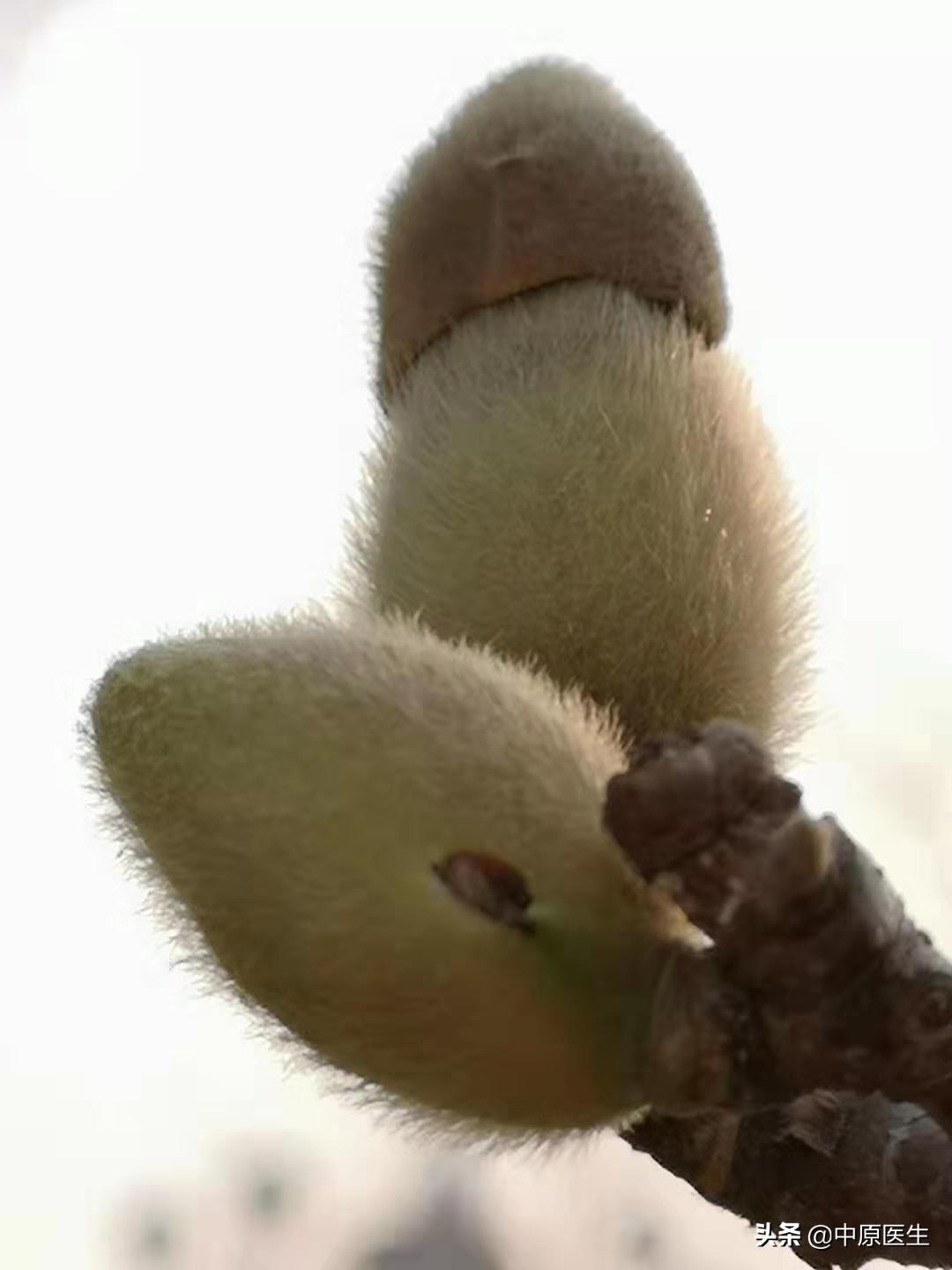 胃部怀疑是溃疡，细心专家又选择窄带光放大检查发现是胃癌