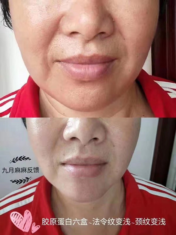 董欣胶原蛋白饮,董欣暖欣代理价