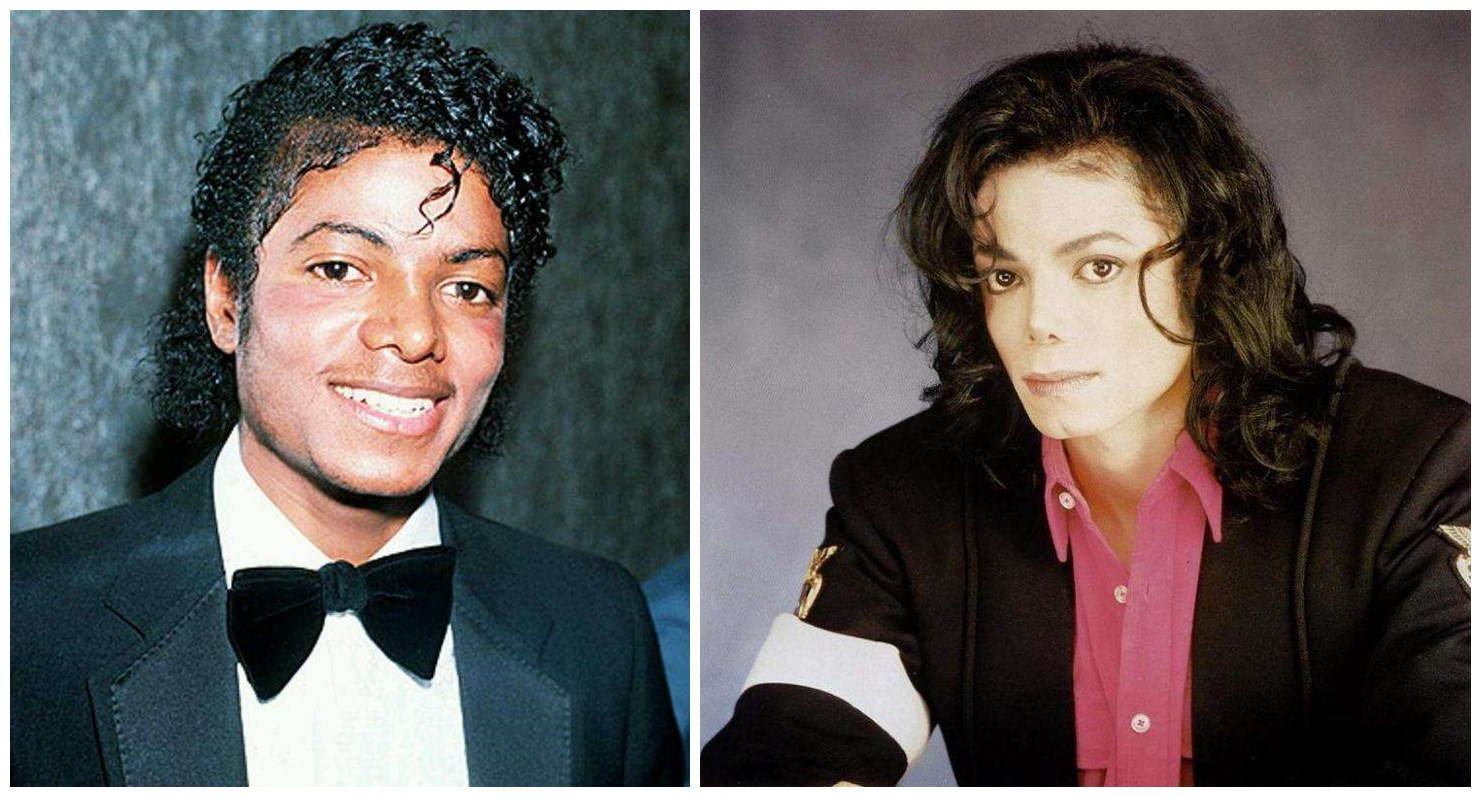 香港女子整容前后,香港女明星整容失败案例