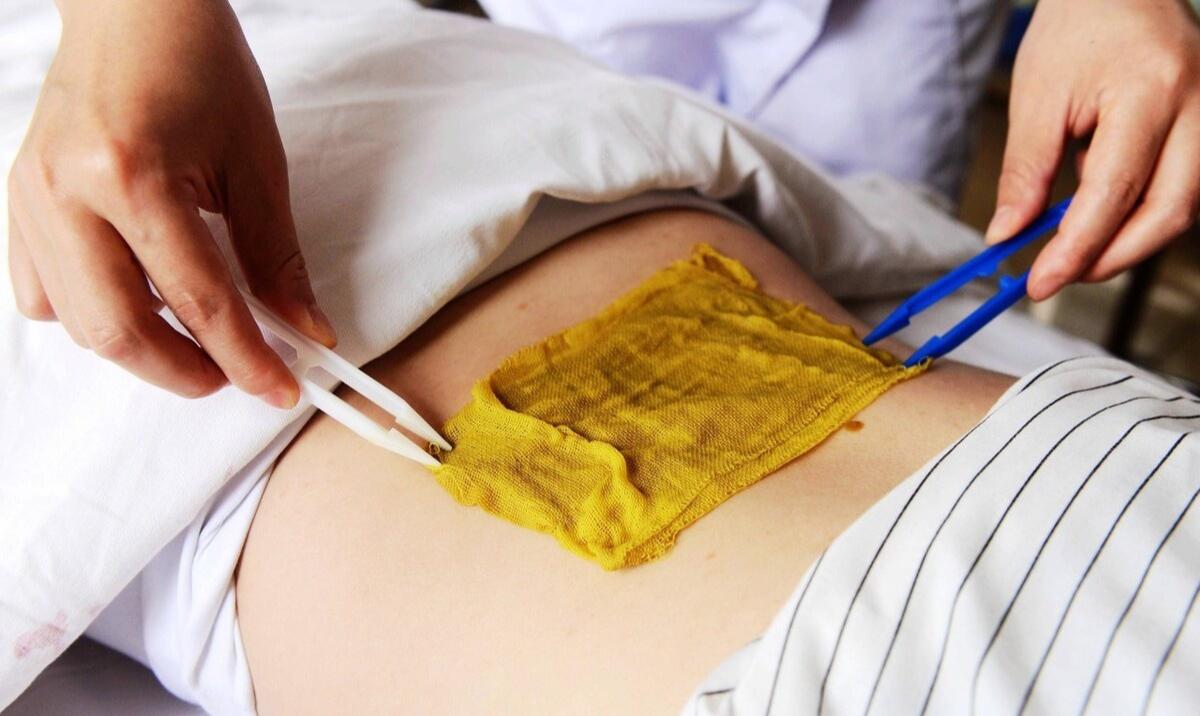 带状疱疹患者如何治疗?祖国医学对其发病机制有较多见解,需了解