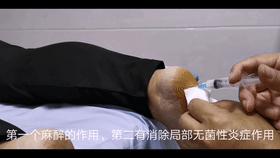 脚后跟痛是怎么回事是不是癌症,跟骨骨刺会引起脚后跟肿疼吗