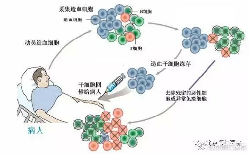 干细胞移植科普知识,移植科普视频