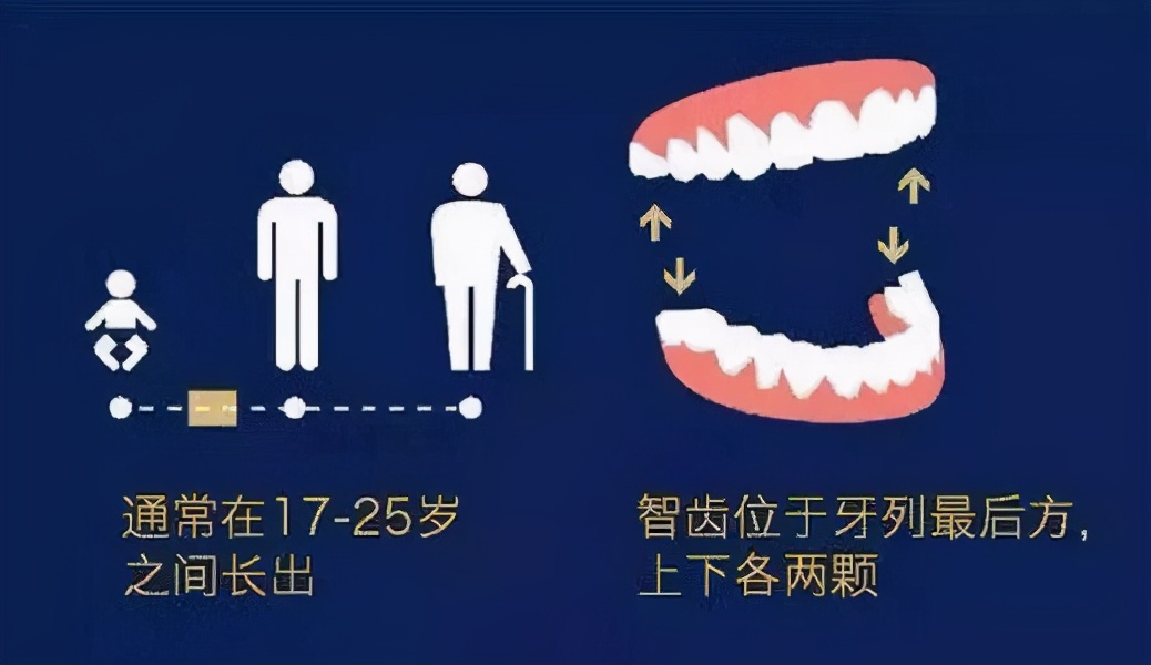 拔智齿注意事项可别大意,真实拔智齿需要注意的事项