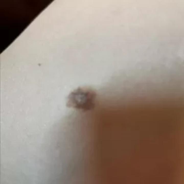 哪些部位长痣预示一生劳碌,痣的位置预示着什么