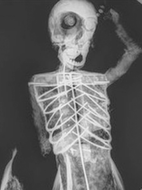 英国的美人鱼标本,英国美人鱼标本