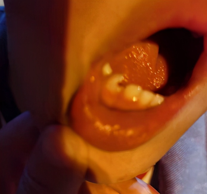 儿砸！为何我磨破嘴皮说安全，你还是上天入地、眼肿、牙碎