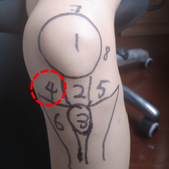 骨科医生教你一招搞定膝盖痛,不同部位膝关节