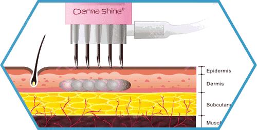 补水神器水光肌组合,水光保湿神器第一名