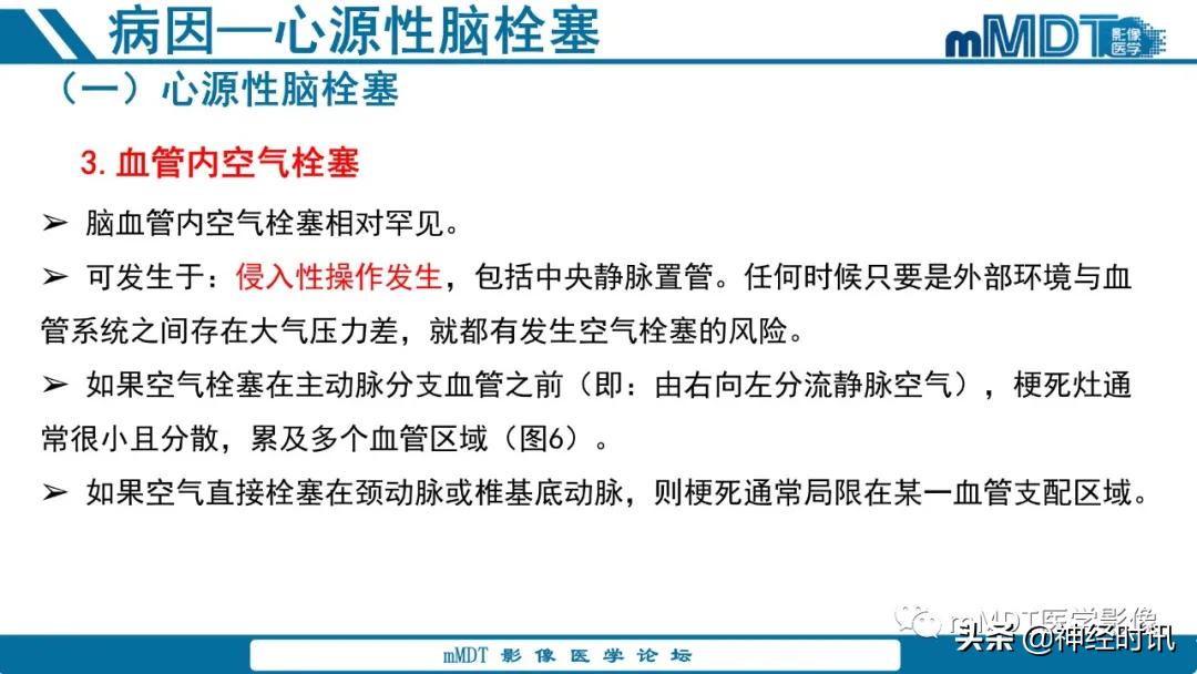 急性缺血性脑卒中ppt素材图片,青年缺血性脑卒中ppt