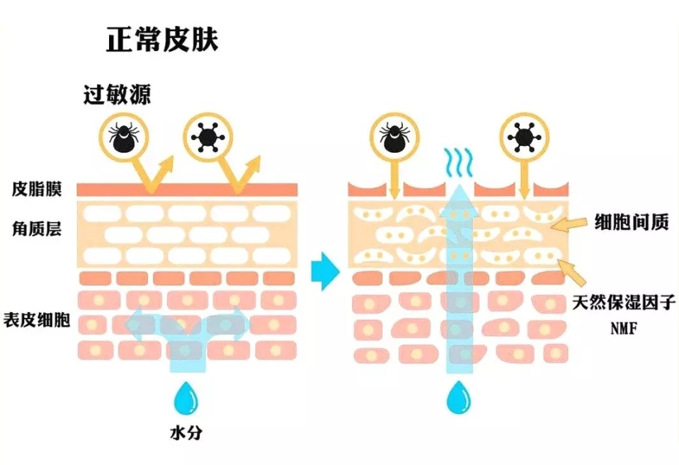 聊聊皮肤保湿有多重要,一招教你保湿皮肤