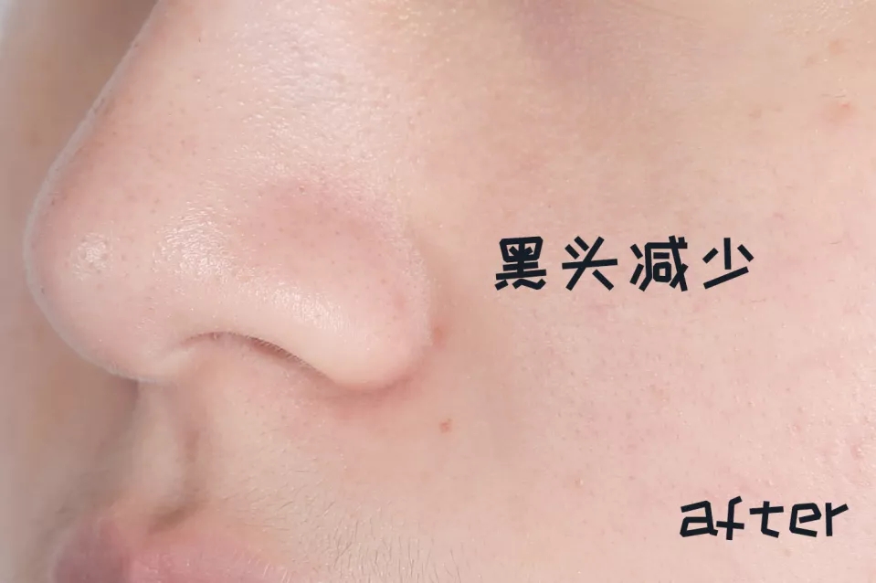 邓紫棋推荐的补水步骤 (邓紫棋使用什么粉底色好)