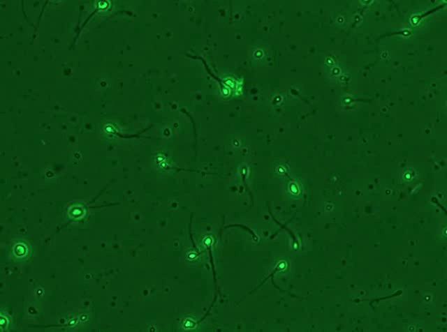 精子是如何产生的百科,精子是不是每天都能生成