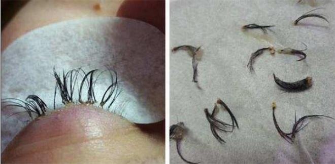 为什么女生不愿意嫁接睫毛呢,美睫师为什么不愿意单根嫁接