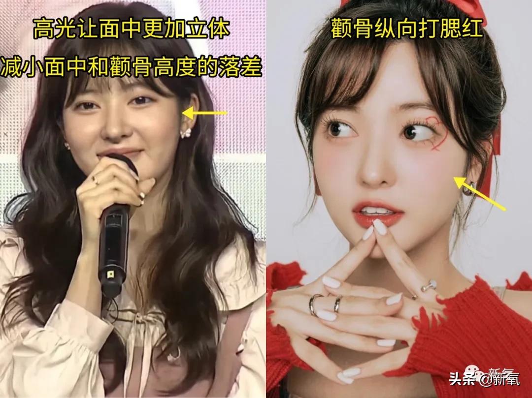 阔面脸轮廓怎么做,阔面脸怎么做医美