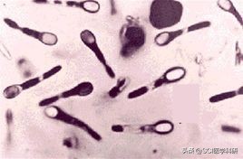 粪便移植能治什么病,粪便移植可以治疗便秘么